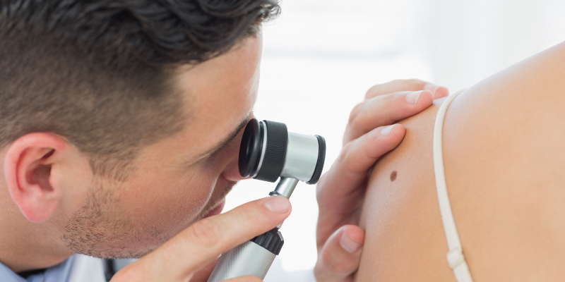 Dermatoskopija madeža u Zadru
