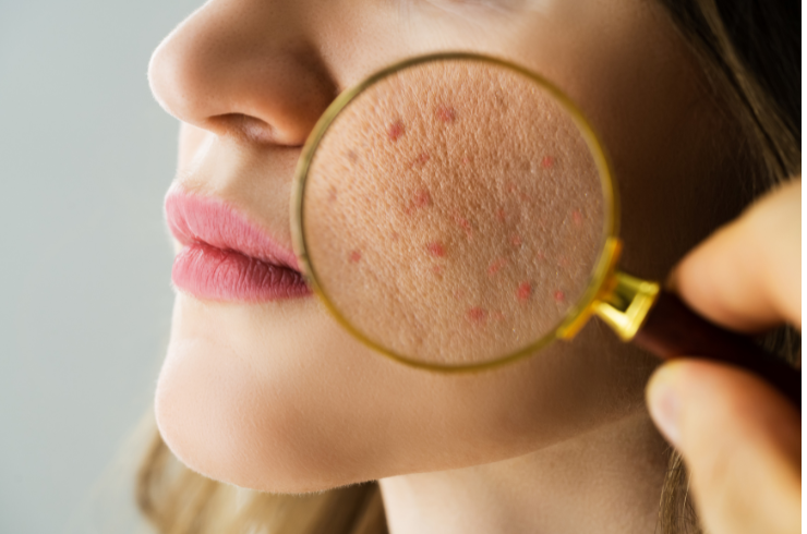 Dermatološki pregled u Poliklinici Kranjčec