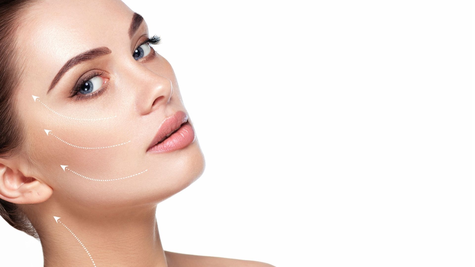 Radiesse biostimulator