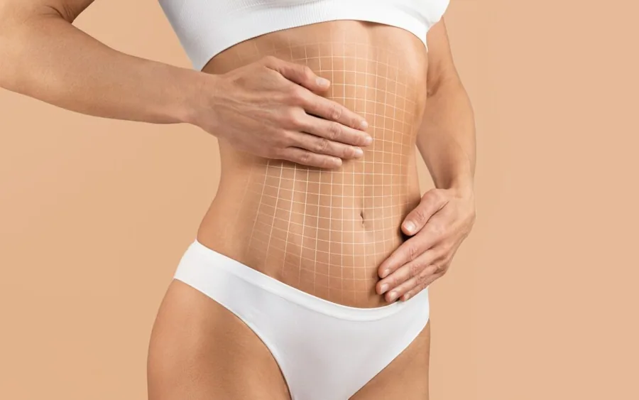 Abdominoplastika i zatezanje trbušne stijenke