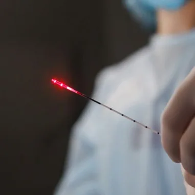 BioLitec Leonardo laserski zahvat
